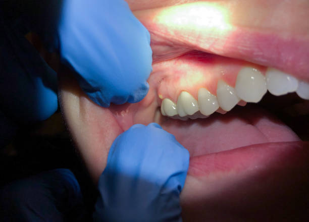 Best Tooth Pain Emergency Relief  in Albion, NY
